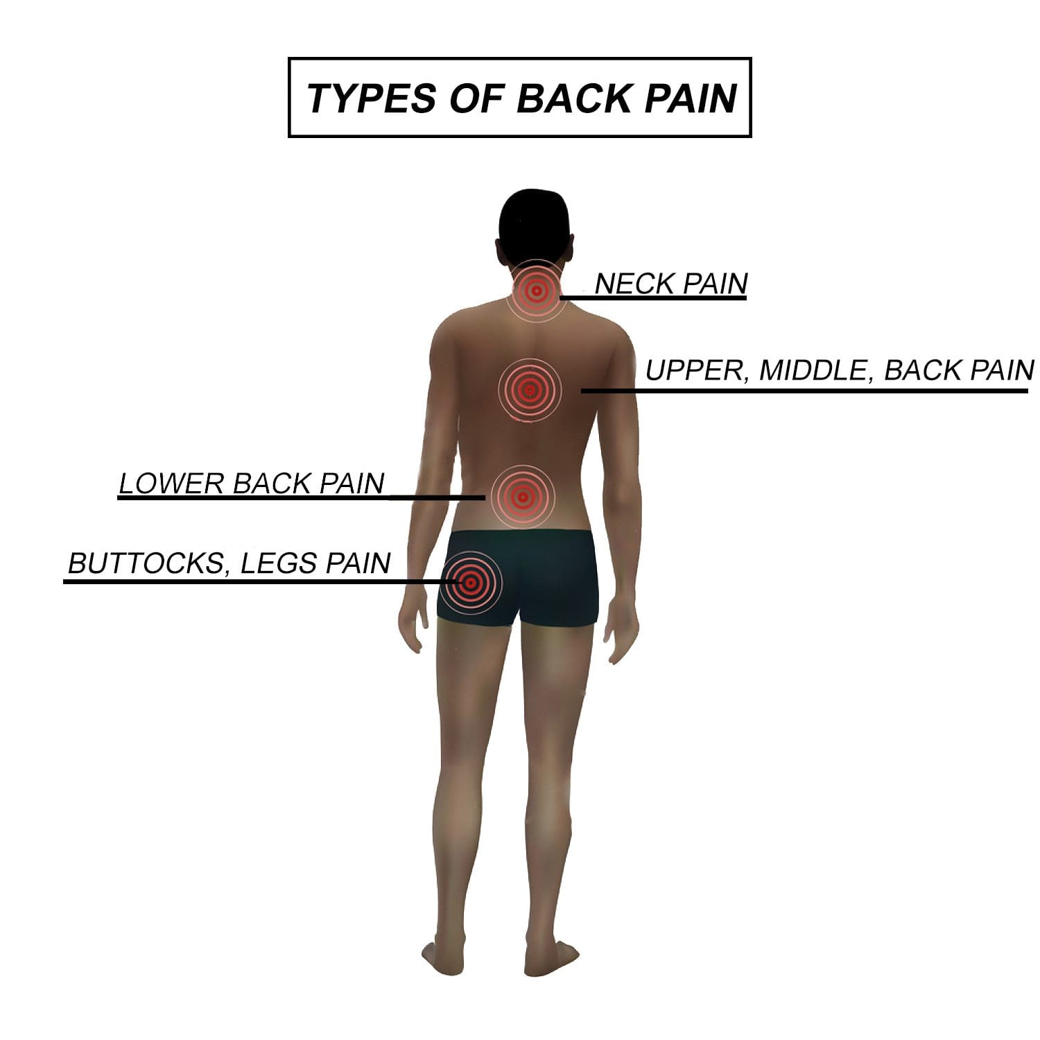 blog illustration of person with various types of back pain