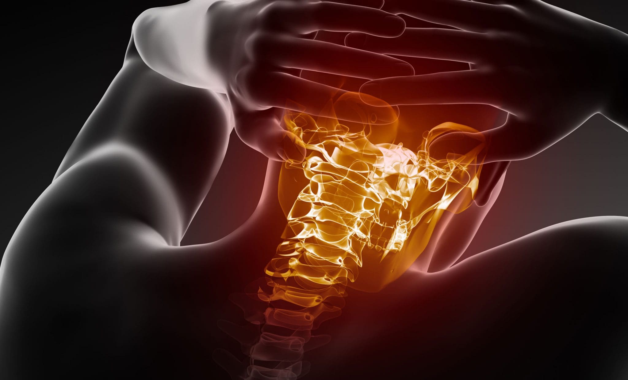 Broken Neck: X-Ray Diagnosis and Treatment - El Paso Chiropractor