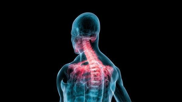 Whiplash Chiropractor Abnormal Cervical Curvatures - El Paso Chiropractor