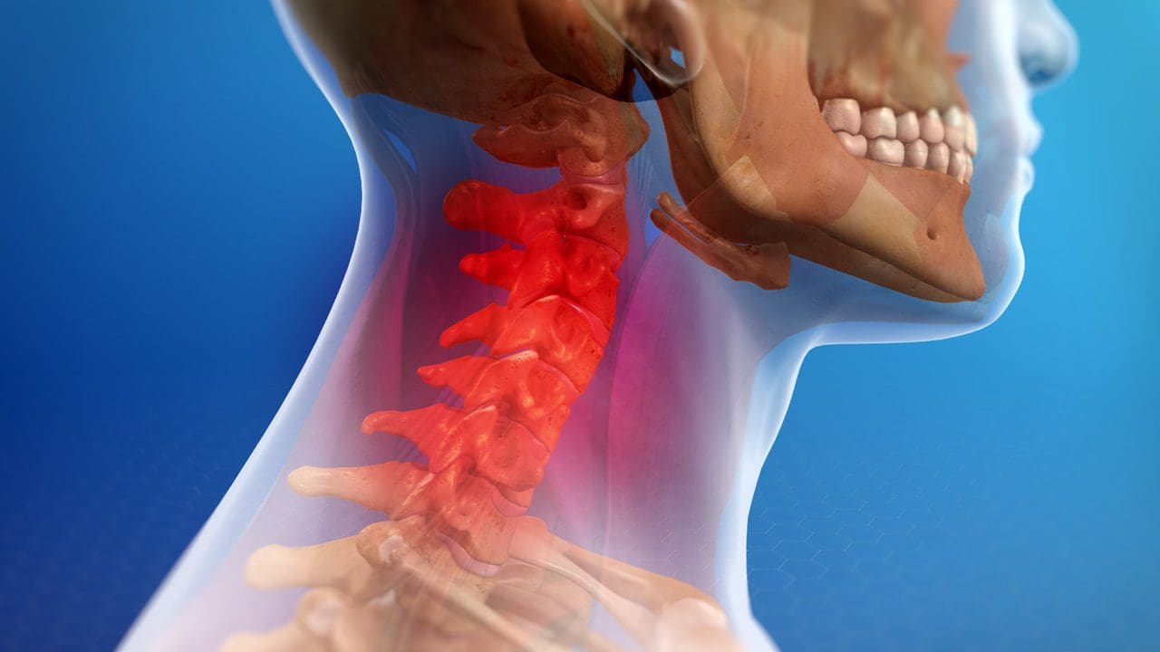 Understanding the Signs and Symptoms of Whiplash Injuries - El Paso Chiropractor