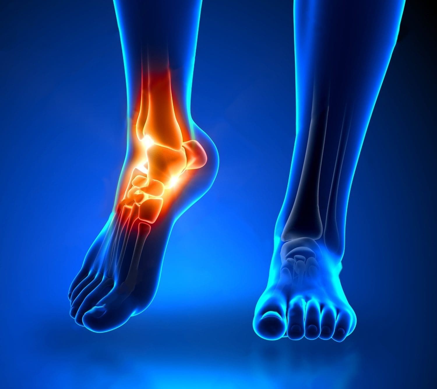 sprain and strain treatment - injury medical and chiropractic clinic el paso, tx.