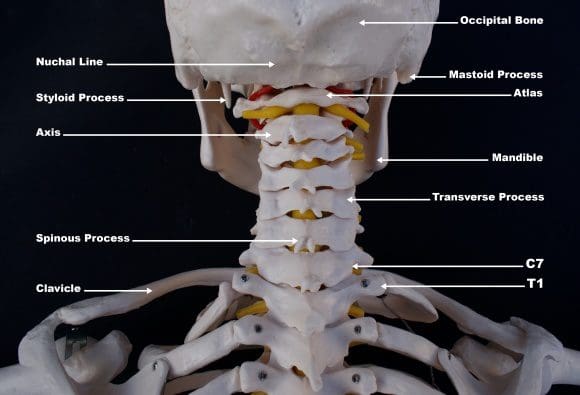 personal injury doctor occiptal_atlast_axis_craniovertebral anatomy