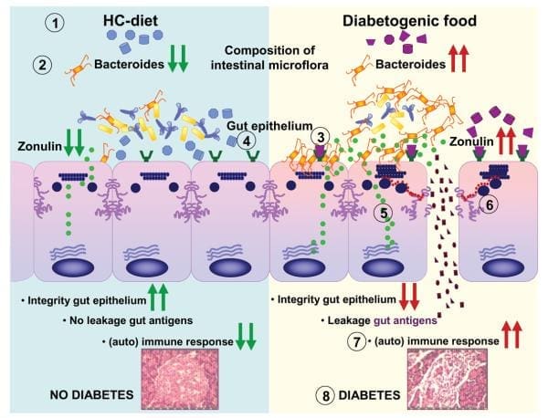 Figure 2 Postulated Mechanism of Action of Gluten in T1D Pathogenesis Image 2