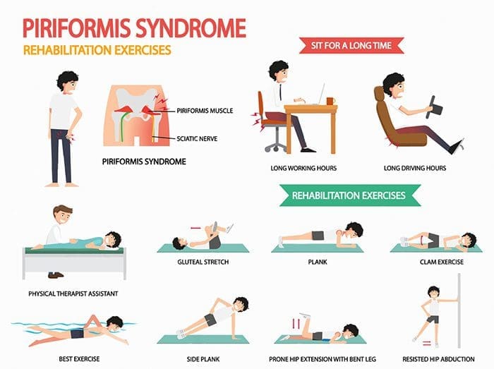 stretches piriformis syndrome pain el paso tx.