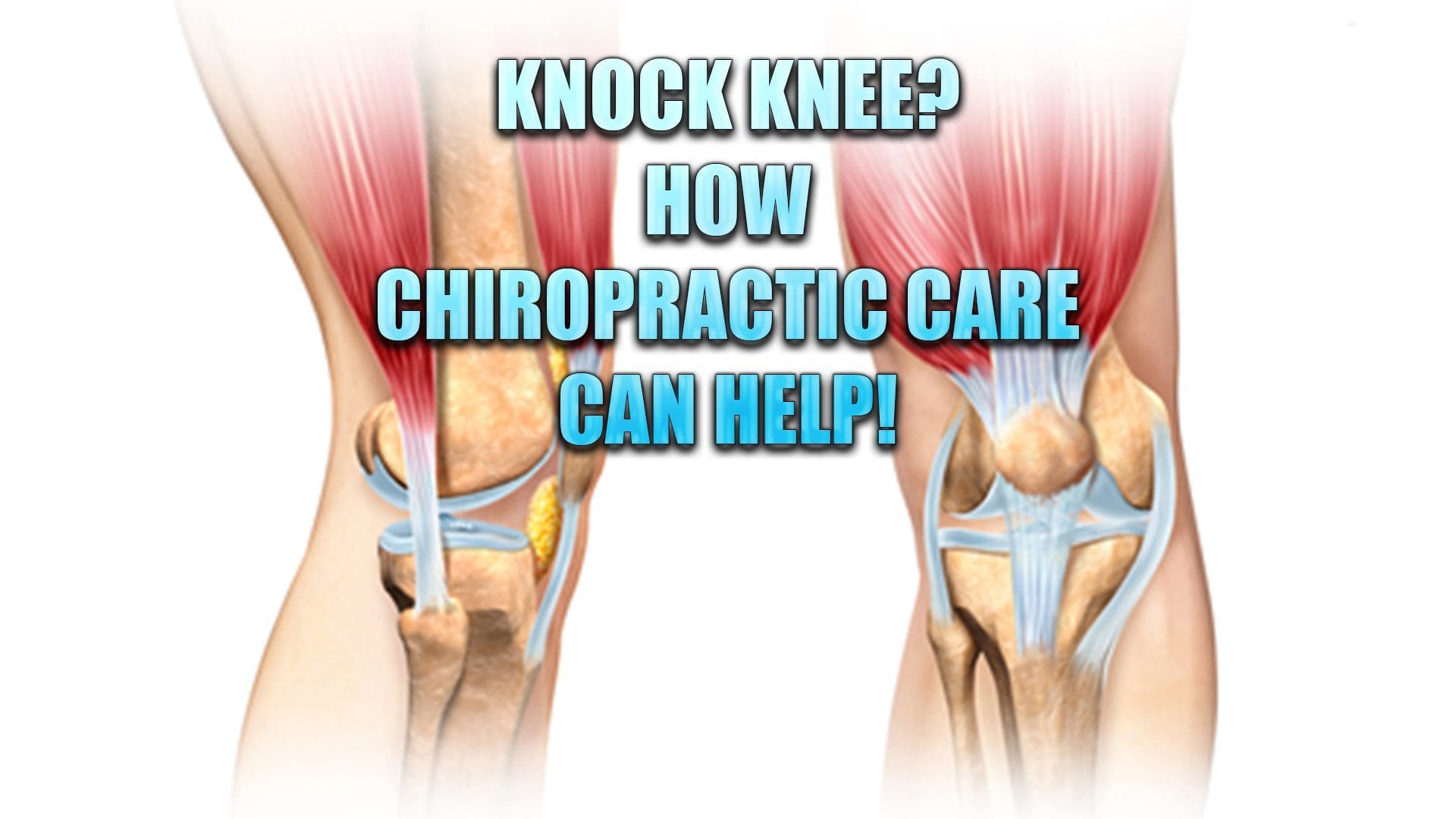 knock knee chiropractic care el paso tx.