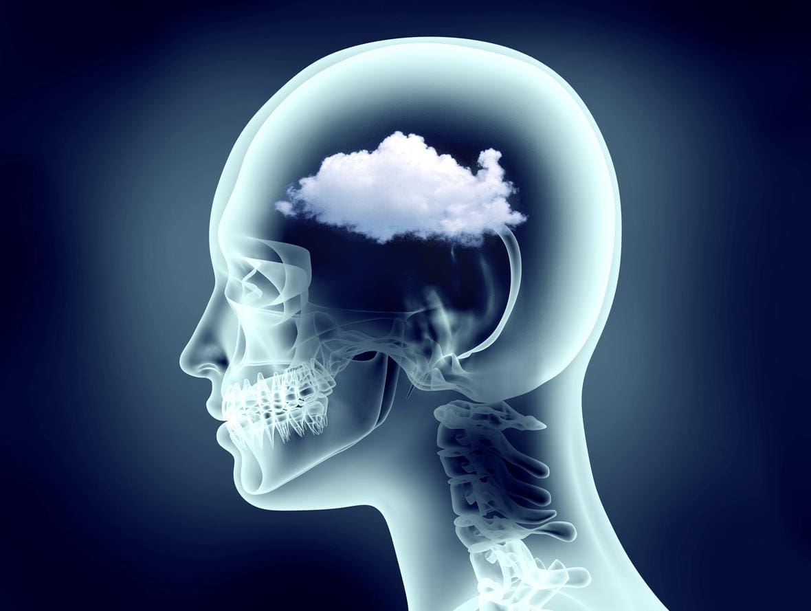 Functional Neurology: Understanding Brain Fog and Head Pain | El Paso, TX Chiropractor